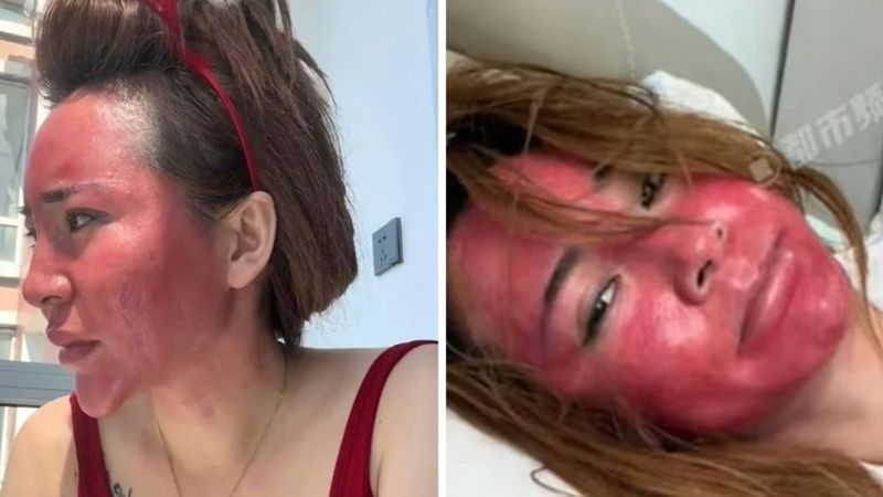 Çin'de yıllarca makyajını silmeden uyuyan kadın sağlığından oldu