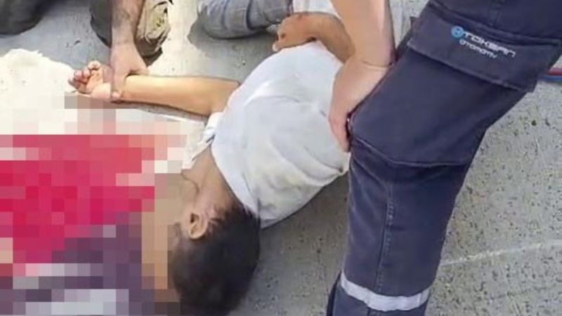 Kocaeli'de tamircileri izleyen şoförün başı damper kapağına sıkıştı