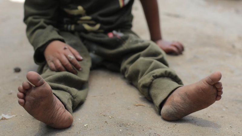 Gazzeli çocukların tedavisini reddeden İngiltere'ye dava