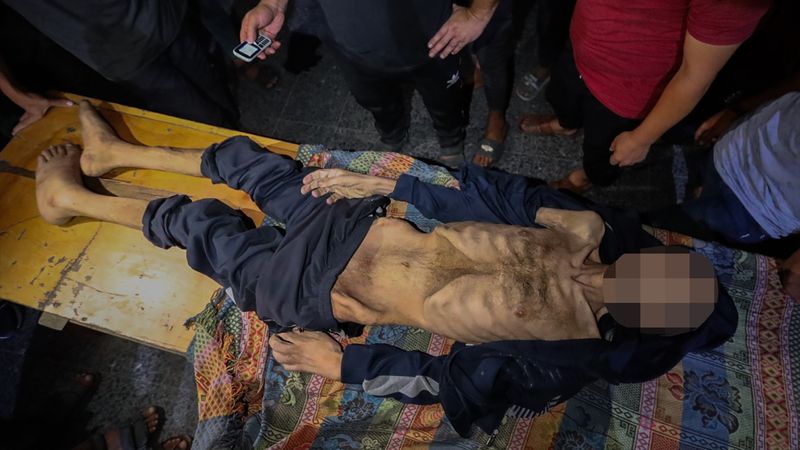 Gazze'de engelli Muhammet yetersiz beslenme nedeniye yaşamını yitirdi