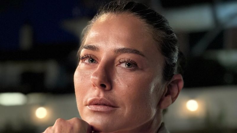 Ece Uslu tatilde hastanelik oldu! 16 dikiş atıldı