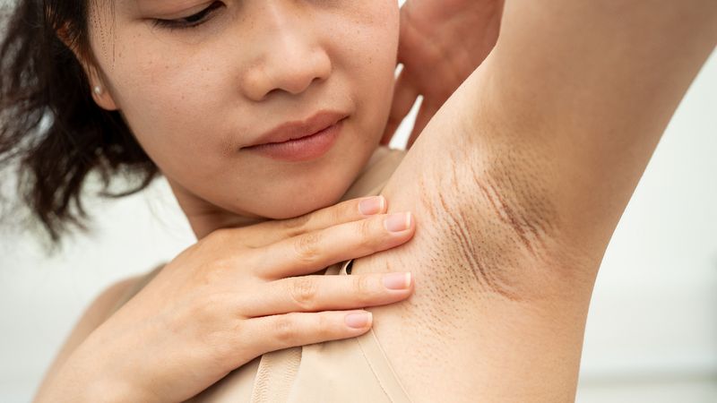 Beslenme alışkanlıkları ter kokusunu etkiliyor