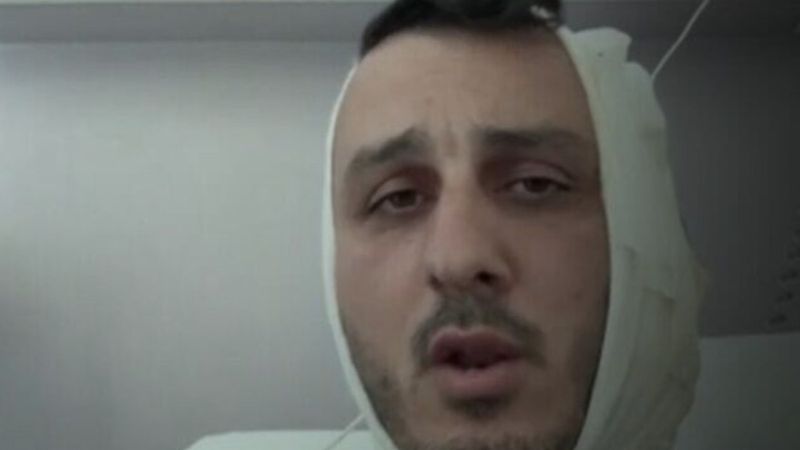 Yunanistan'a tatile giden İsrailli'ye saldırı: Kulağını kopardı