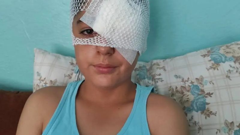 Şanlıurfa'da köpek saldırısından kaçan çocuk yaralandı