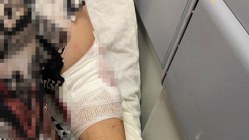 Kocaeli'de abdest almak için bahçeye çıkan kadın köpeklerin saldırısına uğradı