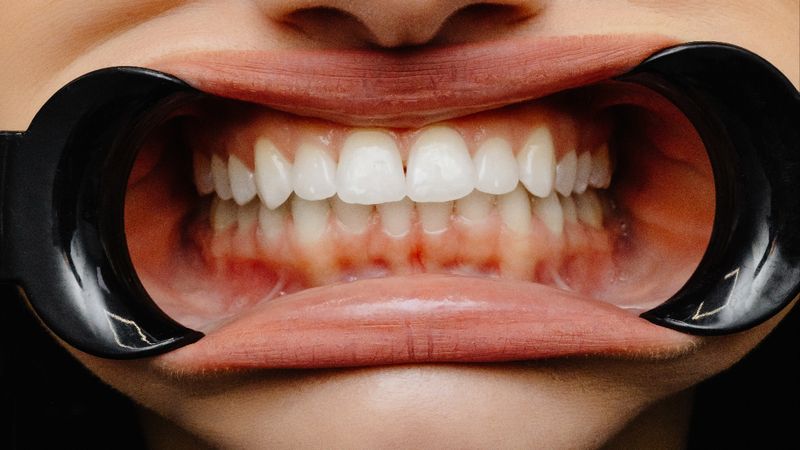 Diş etlerindeki renk değişiklikleri hastalıkların habercisi olabilir