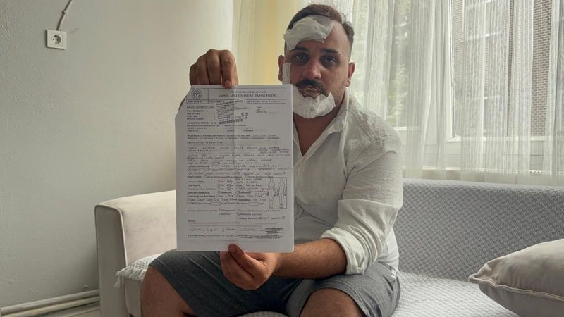 Kocaeli'de taksiciden olay iddia: Eski sözlüm ve ikizinin polis sevgilileri beni dövdü