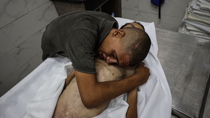 Gazze'de bir çocuk daha açlığa kurban gitti