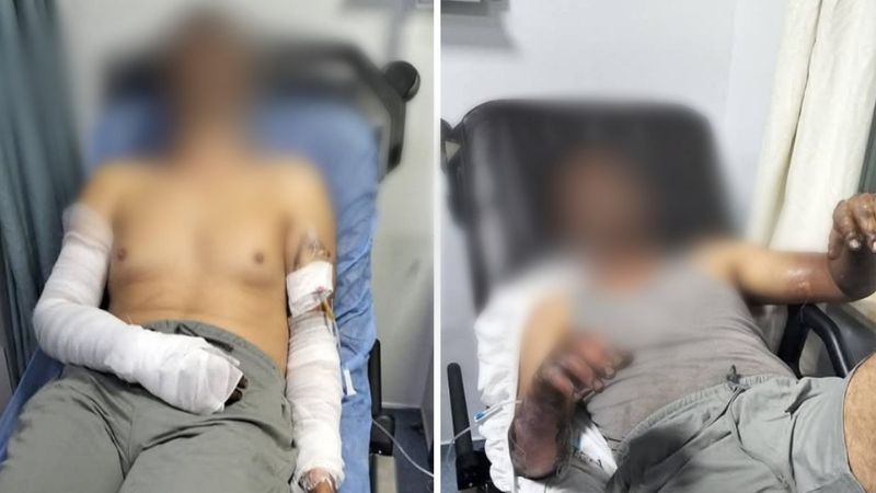 Manisa'da oto tamirhanesinde patlama: 2 kişi ölümden döndü