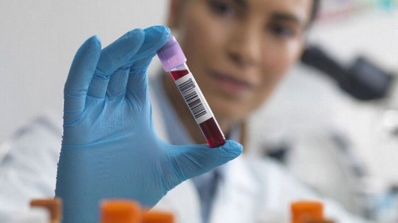 Altın yüzük testi gerçekten işe yarıyor mu? Demir eksikliği nasıl anlaşılır?