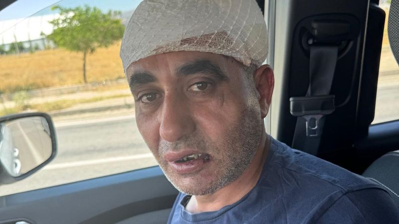 Afyonkarahisar'da eğlence merkezi çıkışında görevliler tarafından darbedildi