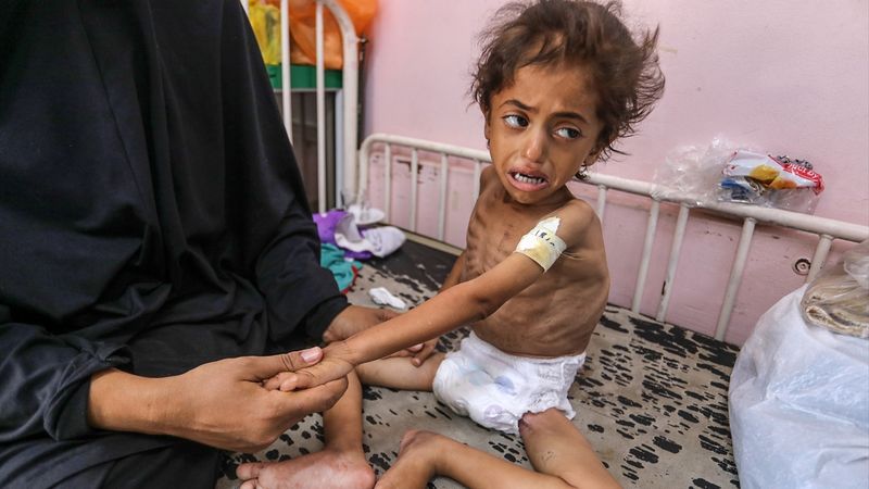 Gazze’de kıtlık can almaya devam ediyor: Çocuklar ölüm tehlikesi altında