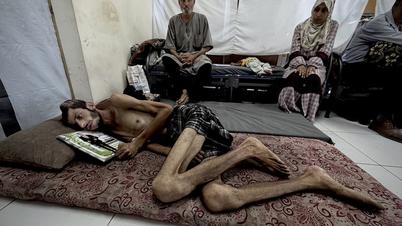 Gazze'de yardım arayışı yaşam mücadelesine dönüştü: İsrail'in saldırısında başından vuruldu