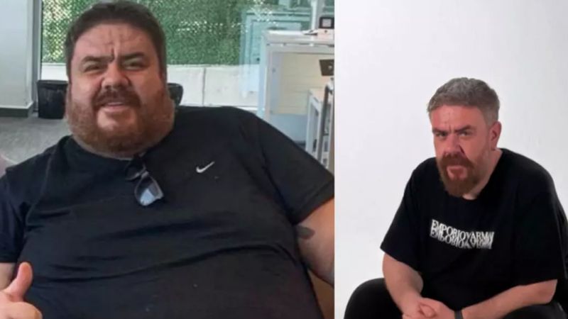 Komedyen Emre Mutlu'nun son hali şaşırttı! 133 kilo verdi
