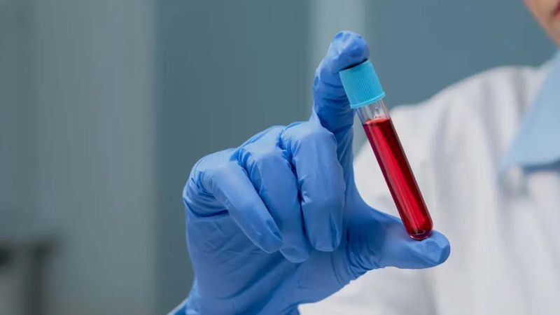 Uzmanlar açıkladı: 0, A, B, AB kan grubu nasıl beslenmeli? İşte, uzak durulması gerekenler