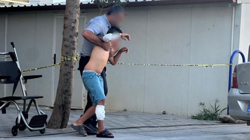 Adıyaman'da başıboş köpek, çocuğa saldırdı