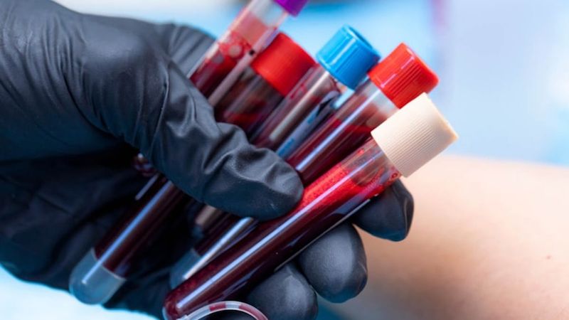 Kan grubuna göre en ideal meslekler belli oldu! A, B, 0 ve AB…