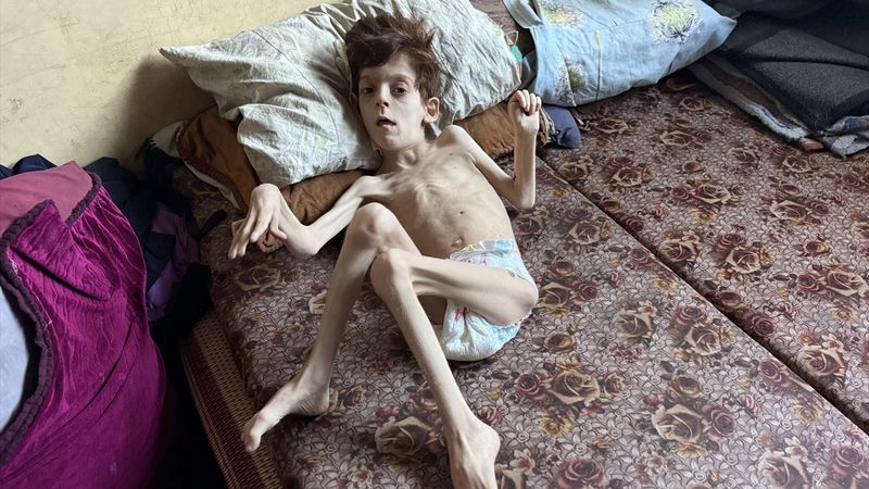 Gazze'de insani kriz: Filistinli çocuğun yaşamı tehdit altında