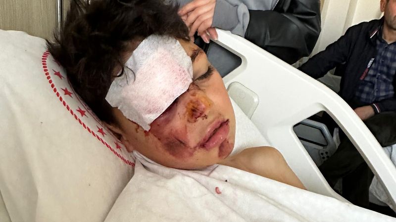 Aksaray'da 12 yaşındaki çocuğa çarpıp kaçtı