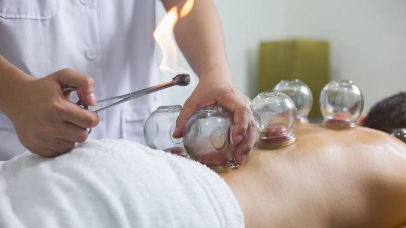 2025'in son hacamat günleri: Aralık ayı sünnetli hacamat takvimi