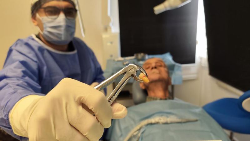 Manisa'da 83 yaşındaki adamın 20'lik dişi çıktı