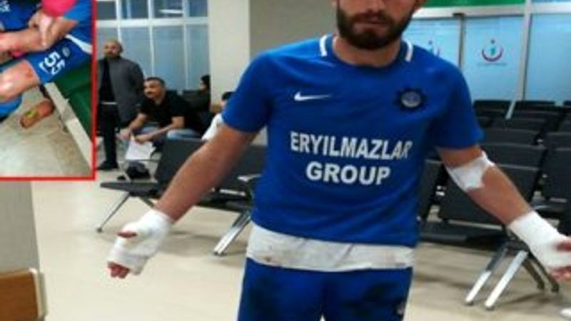 Maç sonrası futbolculara bıçaklı saldırı