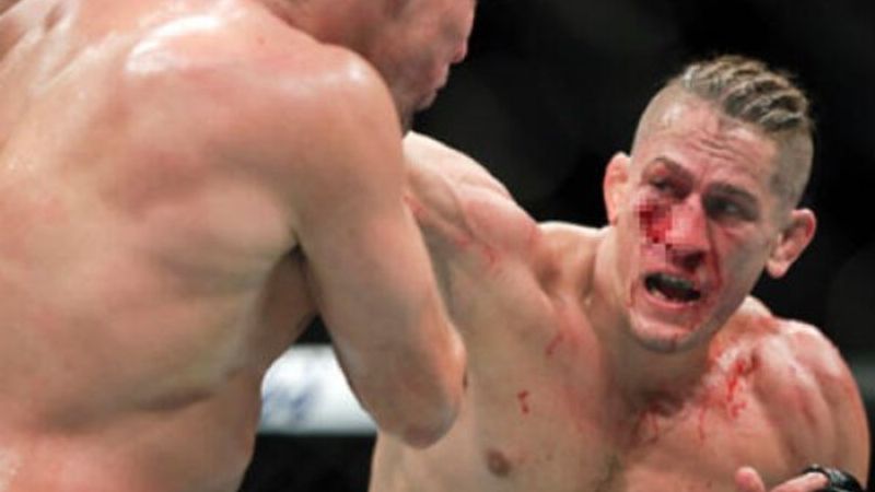 Kafes dövüşü maçında gözü çıkıyordu