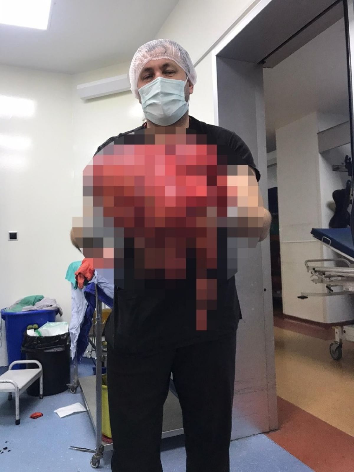 A mass of 14 kilograms was removed from the abdomen in Zonguldak #2