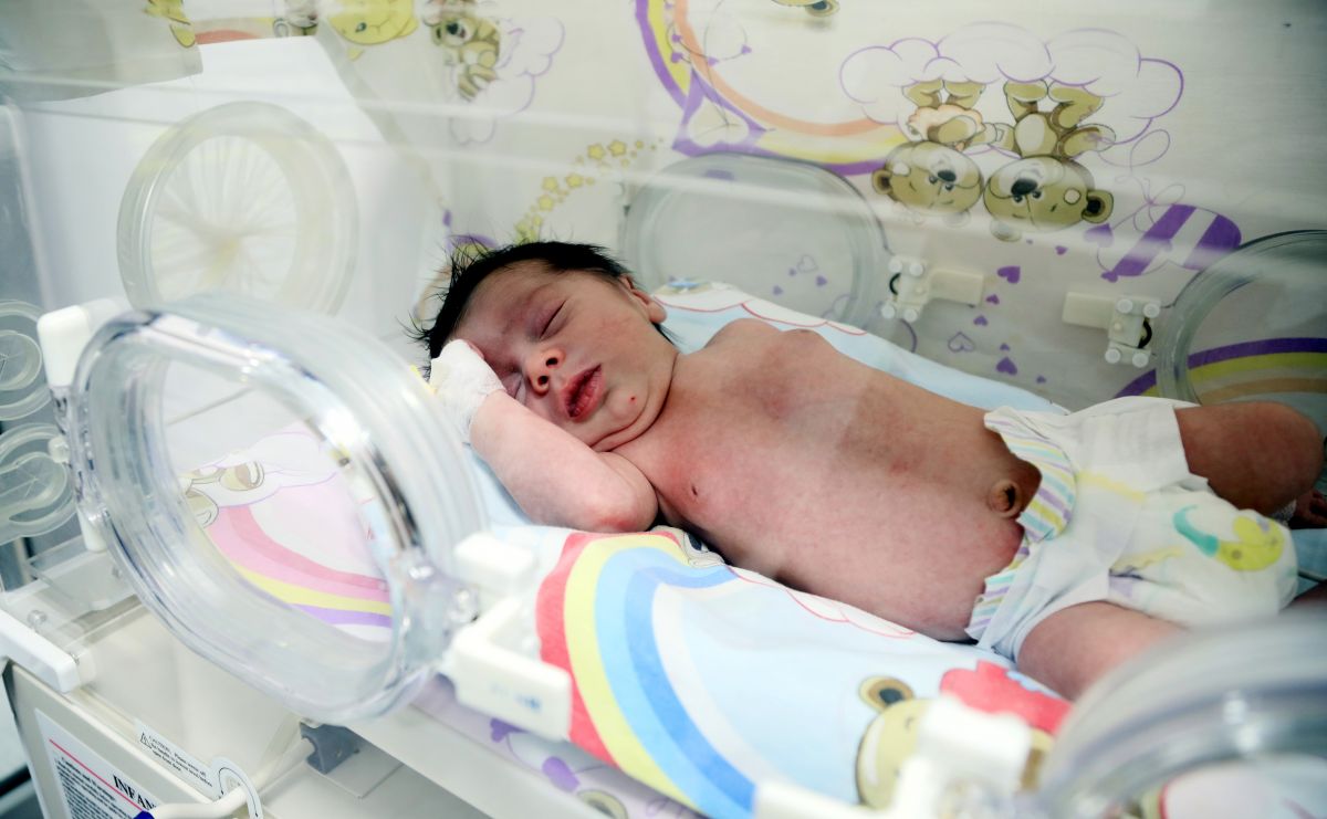 Baby born in Antalya with all internal organs reversed #2