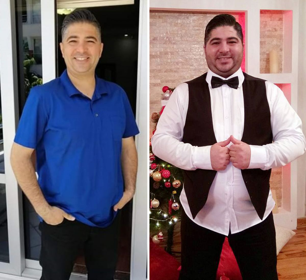 Lost 45 kg in 7 months in Antalya #2