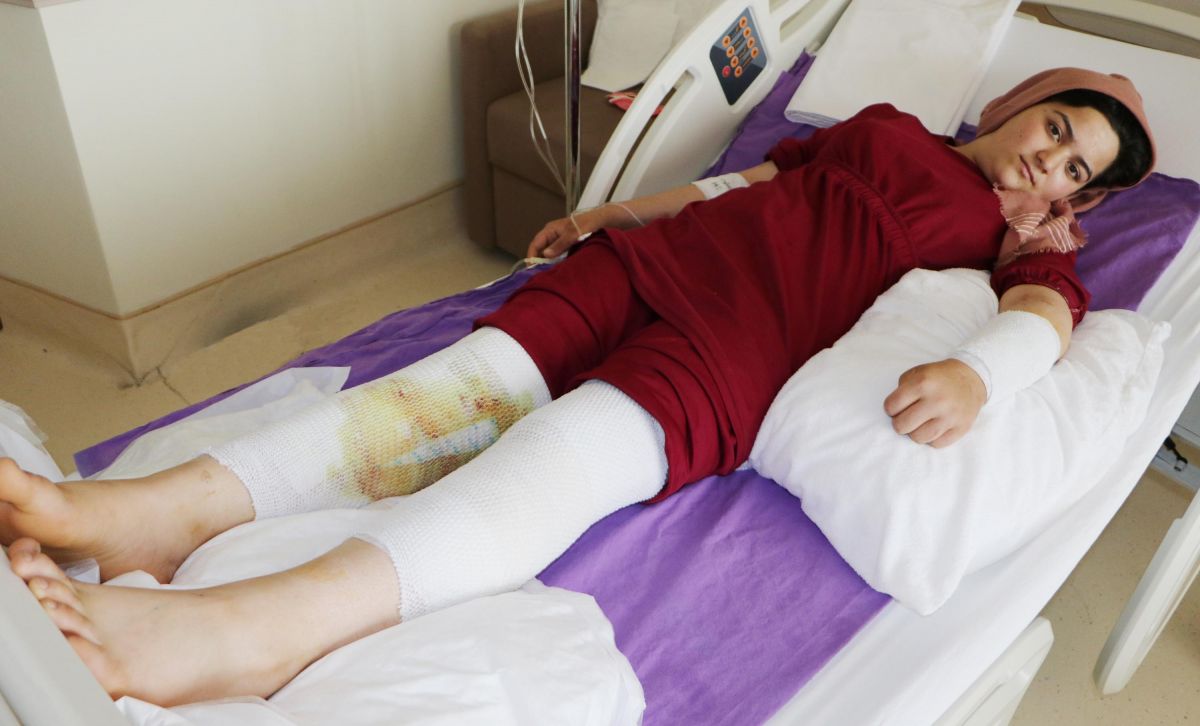 Erzurum'da patlayan düdüklü tencere hastanelik etti