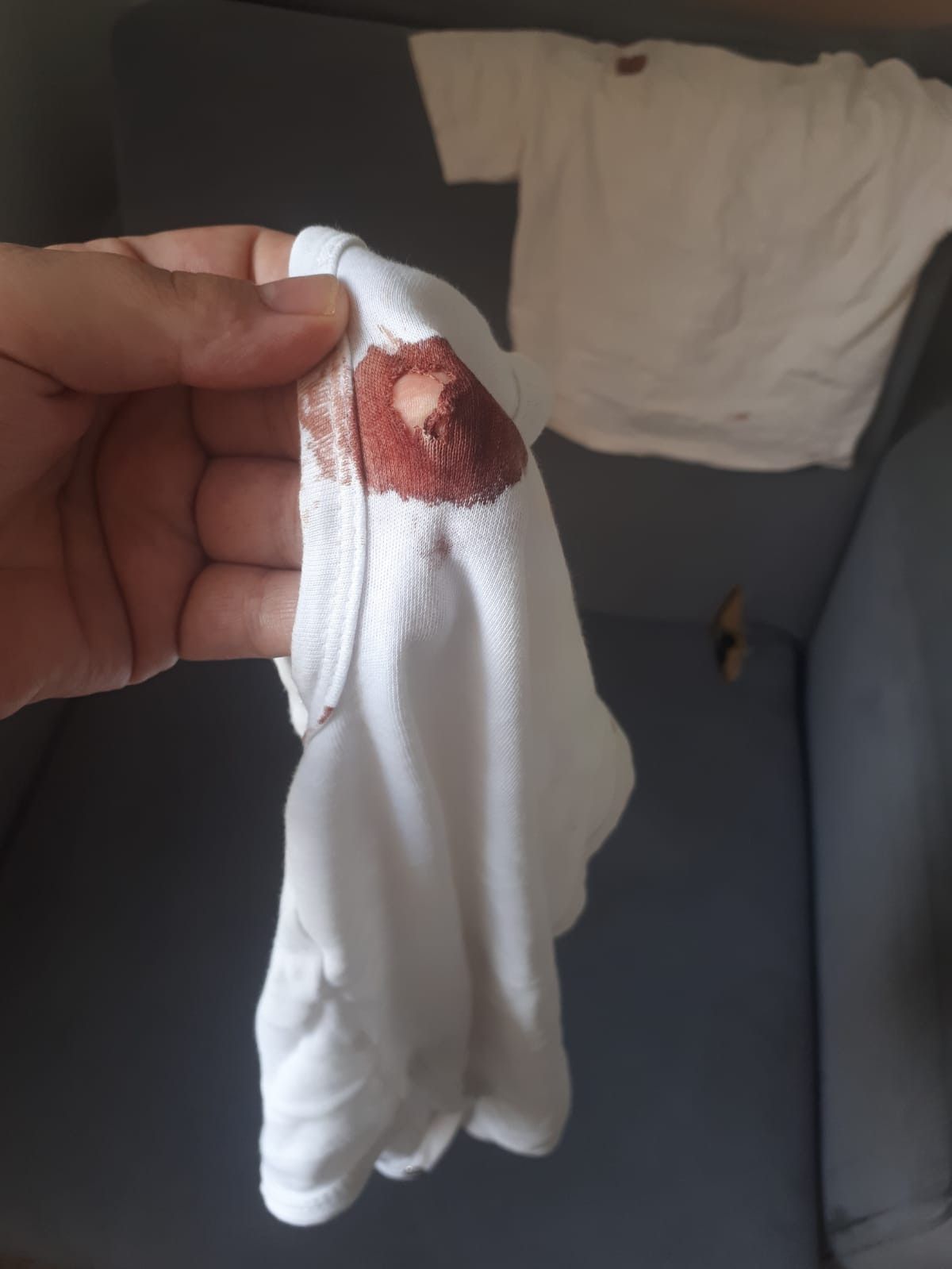 Samsun da maganda kurşunuyla vurulan bebek, koronaya yakalandı #4