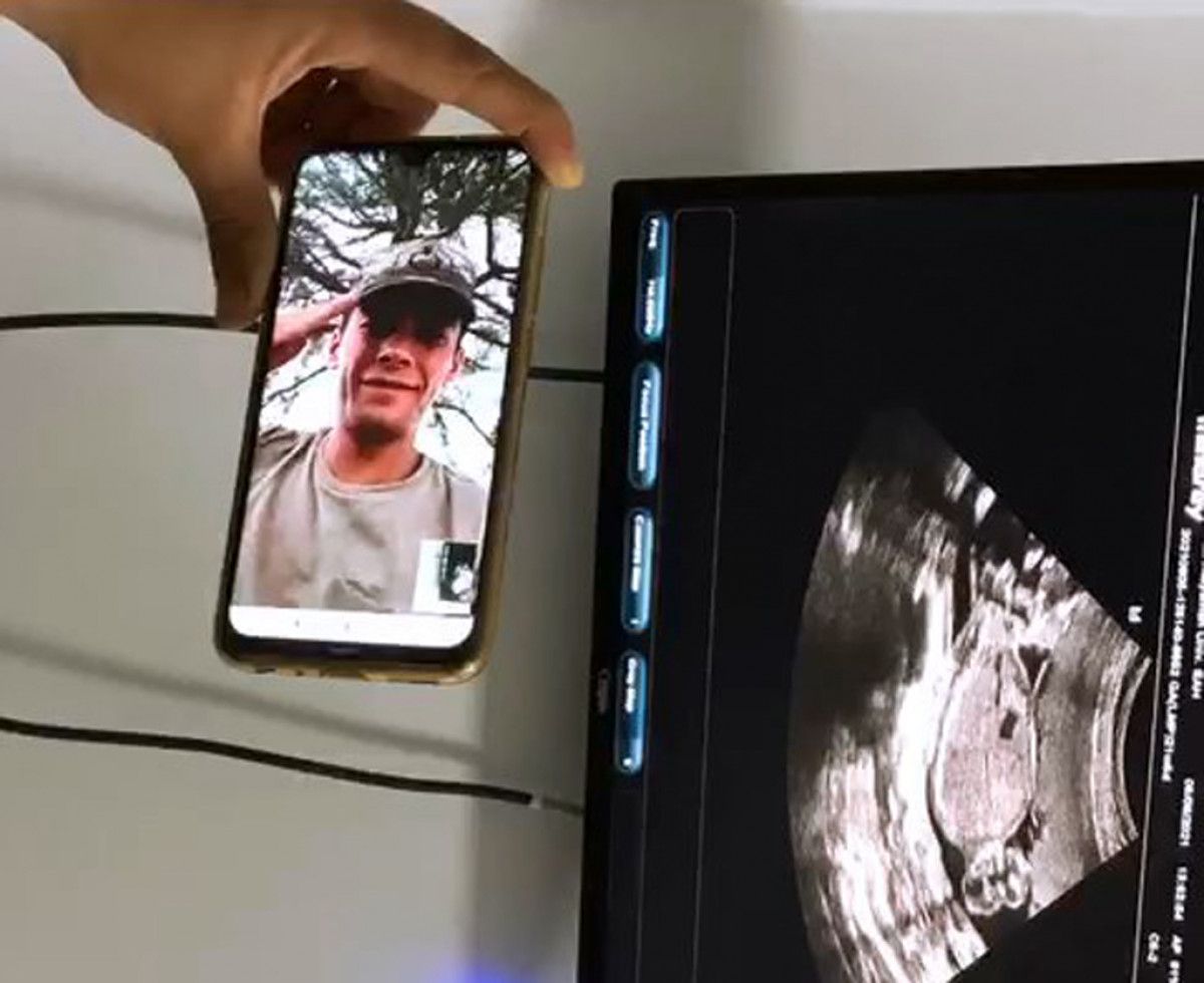 Adıyaman da asker baba, bebeğinin kalp atışını selam vererek dinledi #3