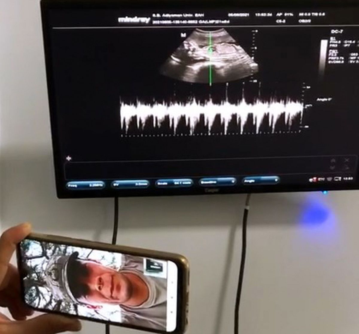 Adıyaman da asker baba, bebeğinin kalp atışını selam vererek dinledi #2