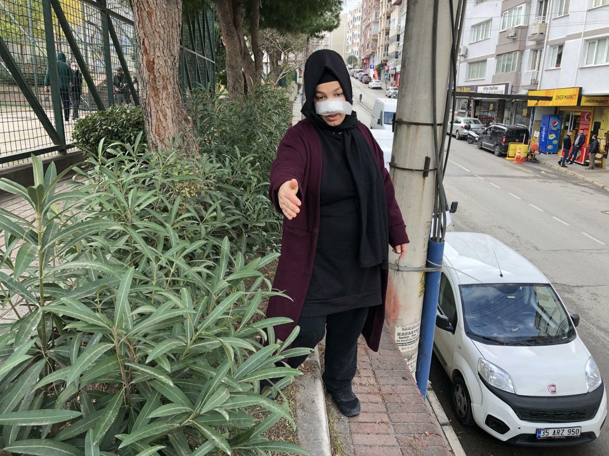 İzmir de yürüyüş yapan kadına pitbull saldırdı #5