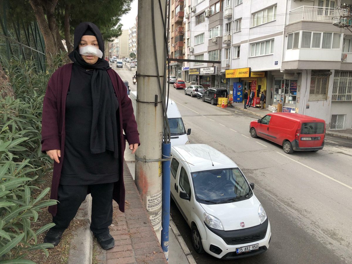 İzmir de yürüyüş yapan kadına pitbull saldırdı #6