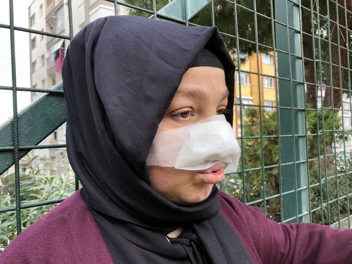 İzmir de yürüyüş yapan kadına pitbull saldırdı #3