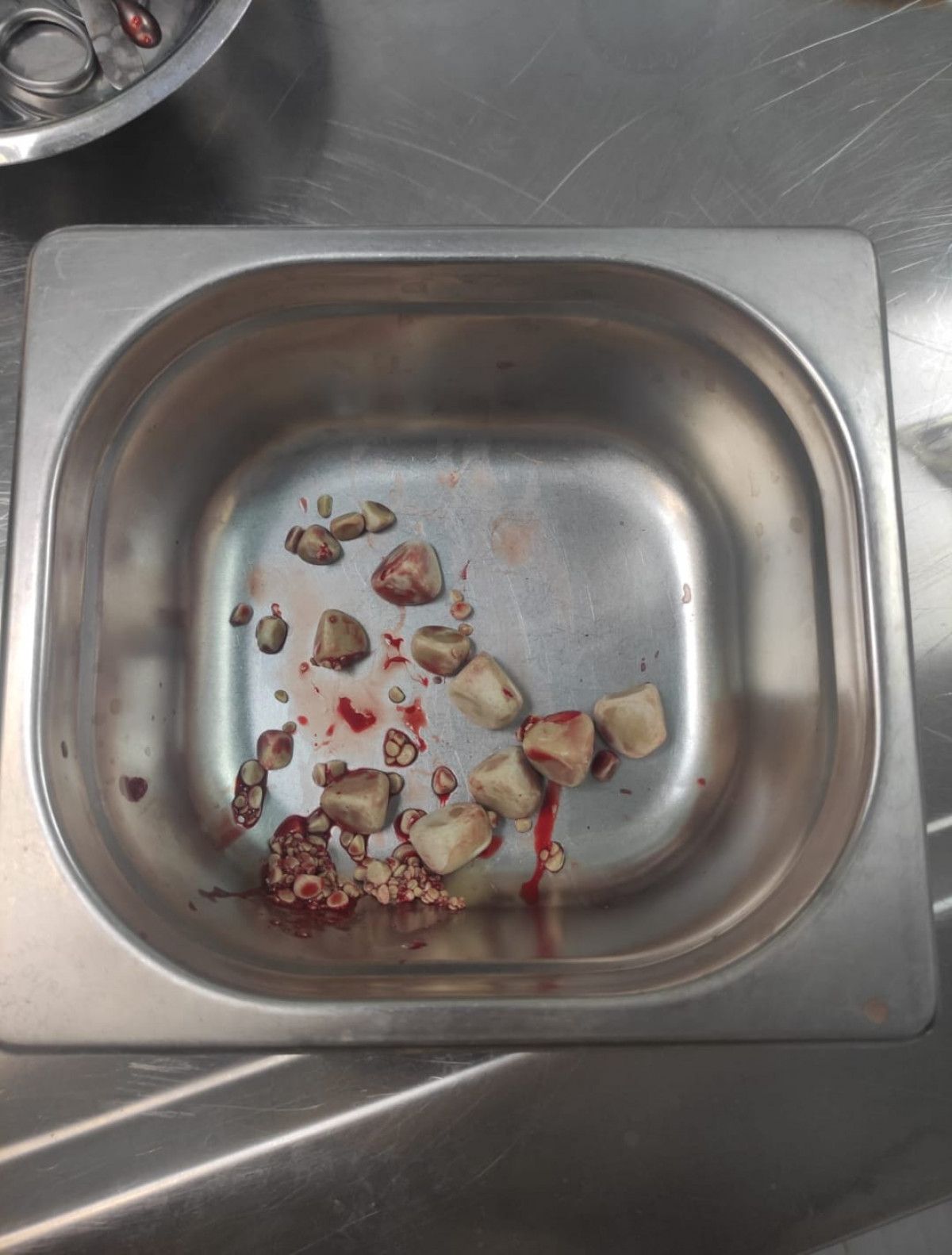 Adana da  Biber  isimli köpeğin mesanesinden 55 parça taş çıktı #4