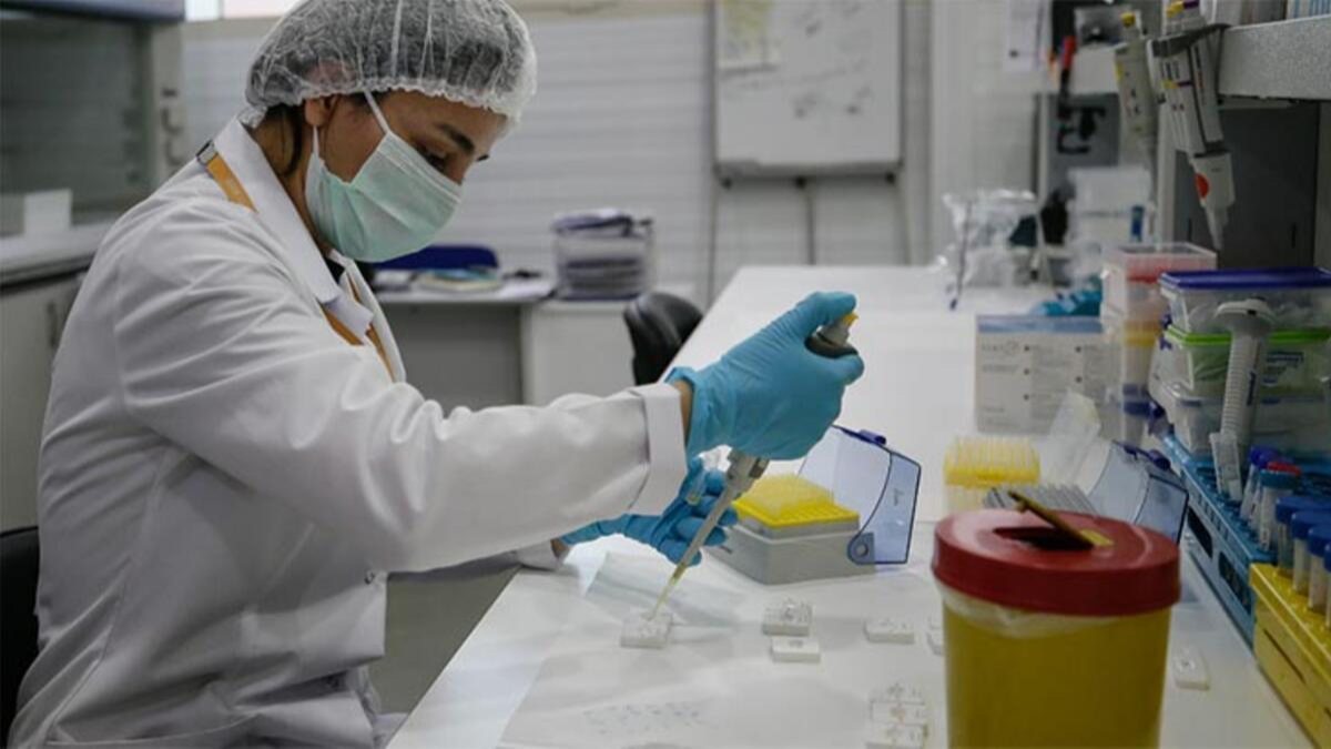 İzmir'de geliştirilen antikor testi 50 ülkeye ihraç edildi