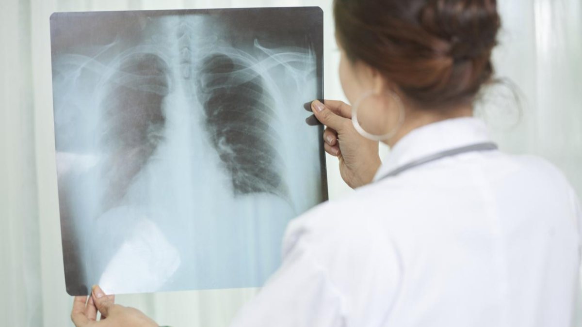 The pandemic process negatively affected the war with tuberculosis