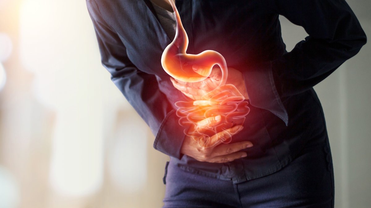 Hepatitis poses risk for esophageal varices