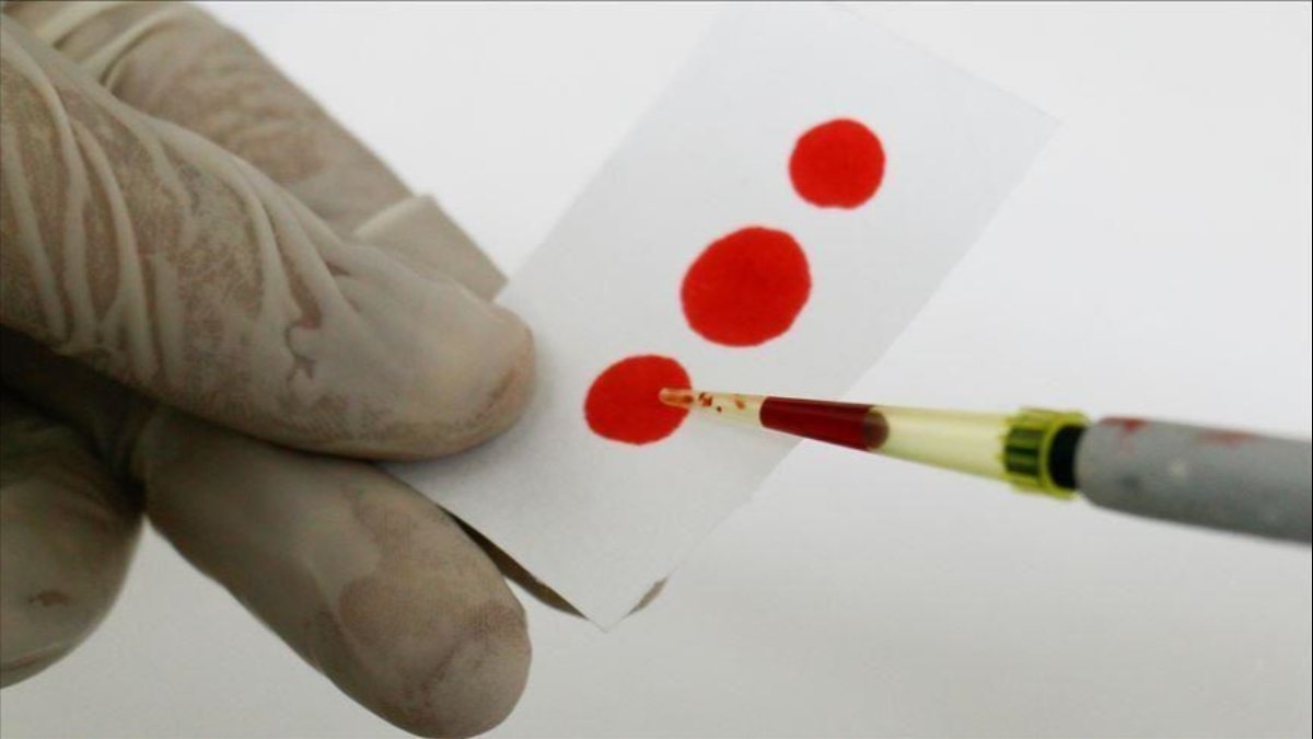 The rarest blood group in the world: Golden Blood
