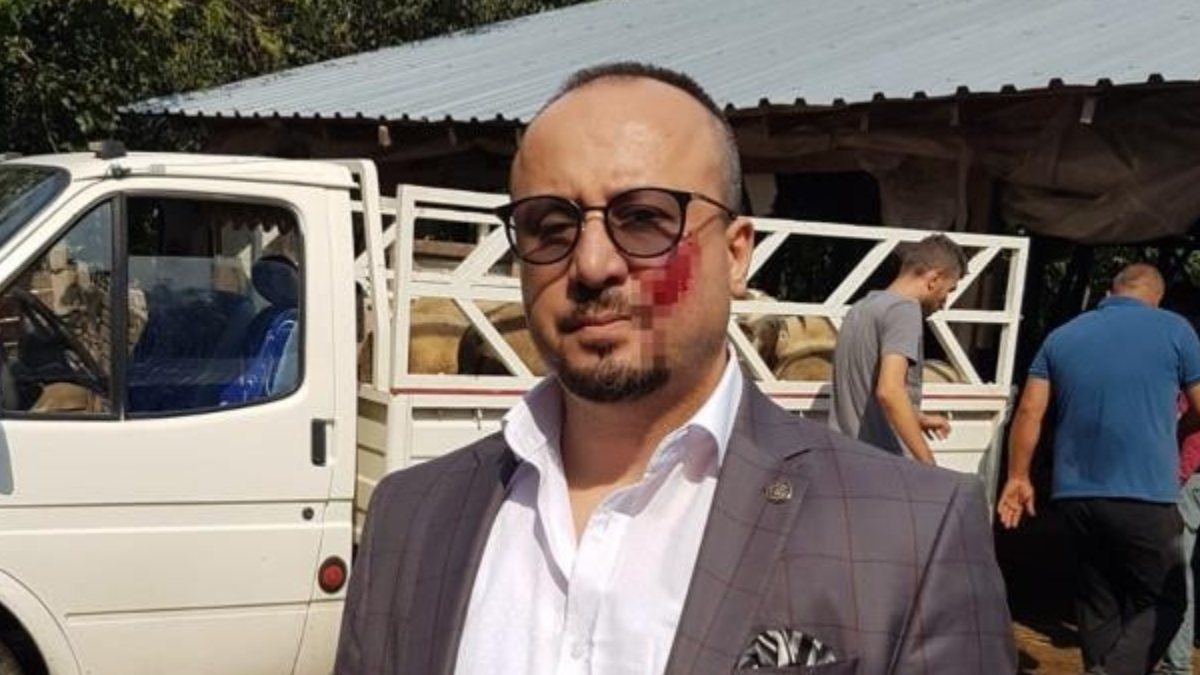 Bursa'da saldırıya uğrayan avukat: Cezayı yeterli bulmuyorum