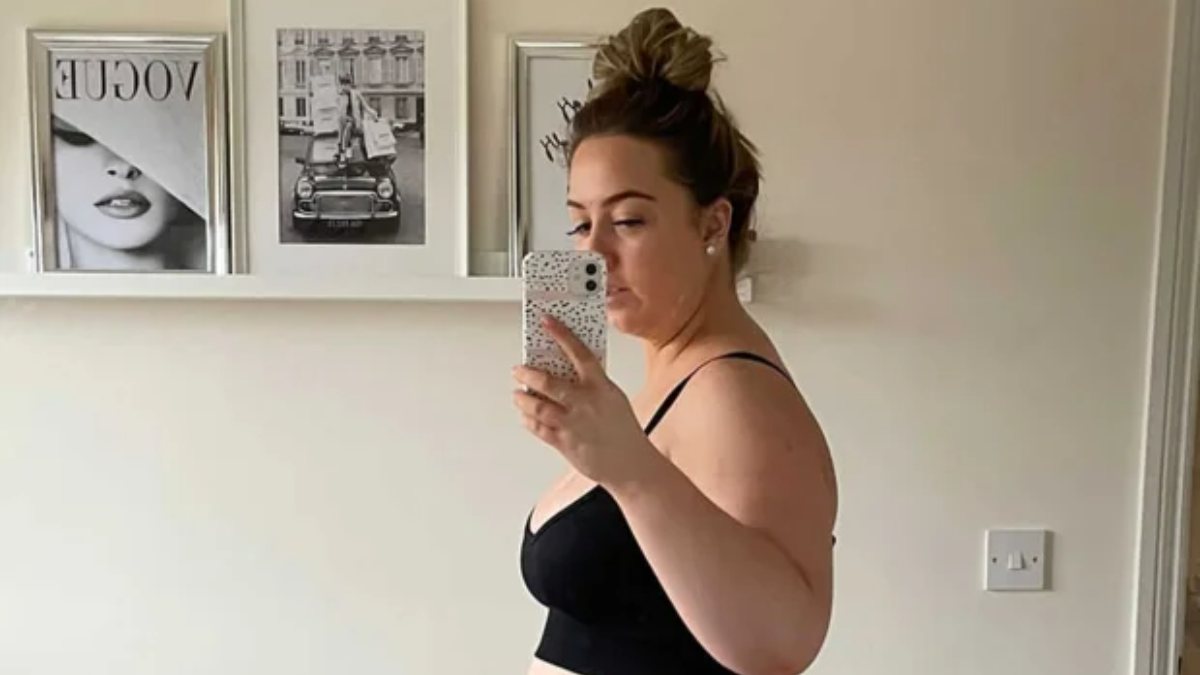 British woman had weight loss surgery in Turkey
