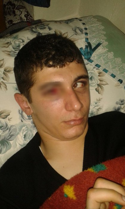 Adana'da engelli gence saldıran 4 kişi gözaltında