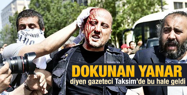 Gazeteci Ahmet Şık Gezi eyleminde yaralandı - izle