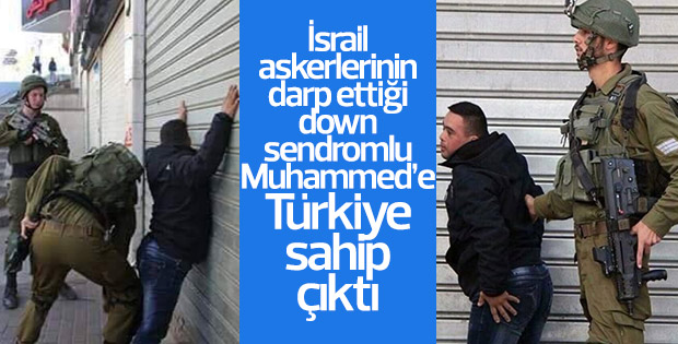 Down sendromlu Muhammed'e Türkiye sahip çıktı