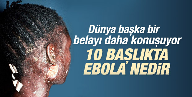 Madde madde ölümcül Ebola virüsü