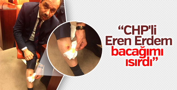 Eren Erdem AK Partili vekili bacağından ısırdı