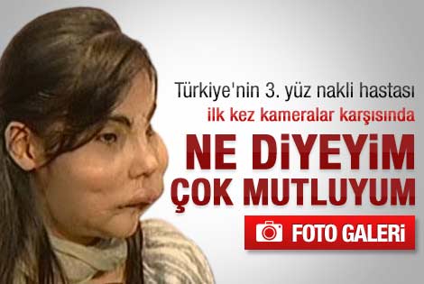 Yüz nakli olan Hatice Nergis ilk kez kameralar karşısında